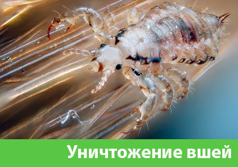 Уничтожение вшей в городе Барнаул